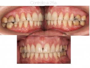 2b 5557 NADIA.030